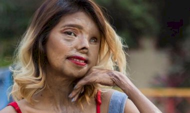 The story of ANMOL RODRIGUEZ